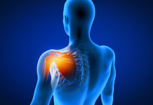 a rendering of shoulder pain