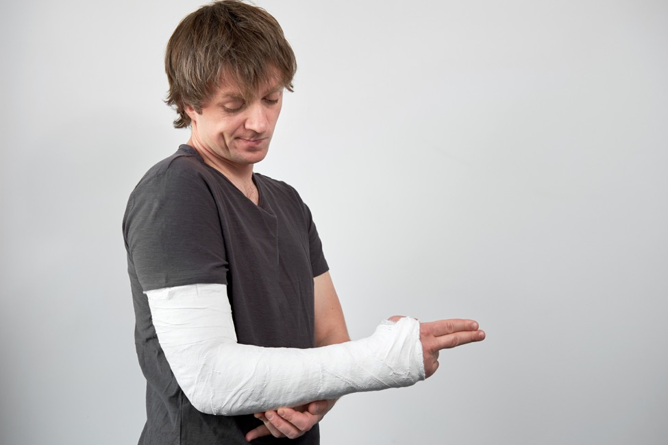  A man with a fractured arm holds his cast 